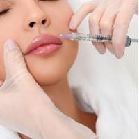 Did you know this about ... Fillers?