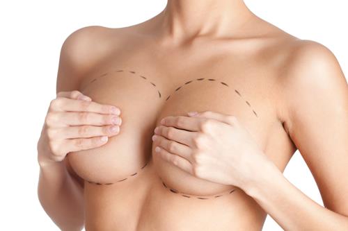 Breast augmentation: new before and after pictures