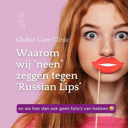 "RUSSIAN LIPS" - REDENEN OM NEE TE ZEGGEN TEGEN DEZE LIPINJECTIE TREND