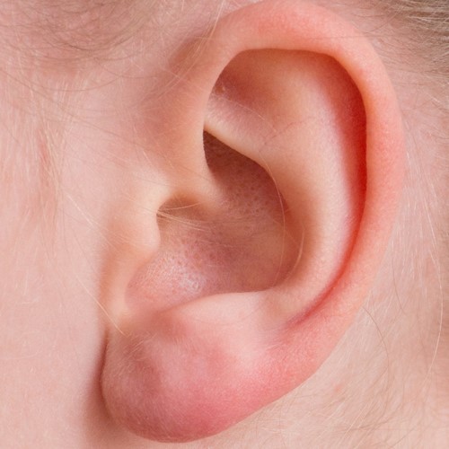 Ear correction