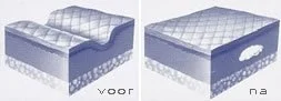 filler met hyaluronzuur