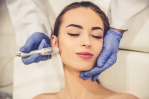 Needling Dr Nelissen