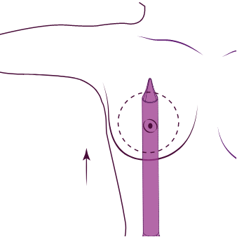 Motiva Channel Separator - Tunneling