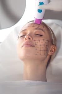 Dr Nelissen Thermage Belgie