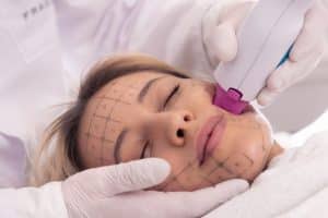 Thermage Belgie Dr Nelissen