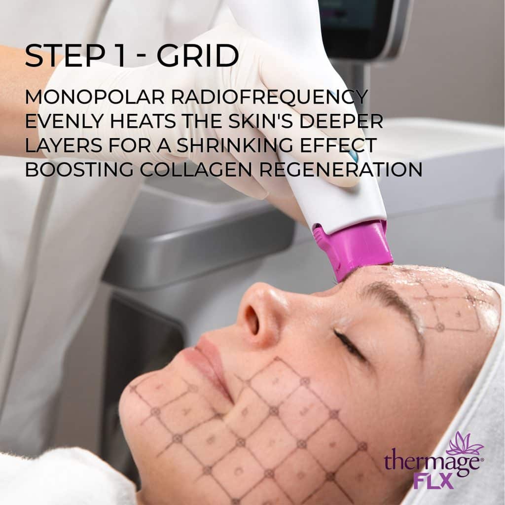 step1-thermage