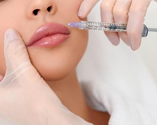 Voor en na foto's filler en skinbooster