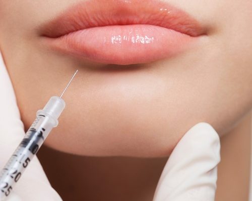 Lipfiller Plastisch Chirurg Nelissen