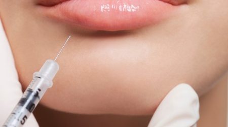 Lipfiller Plastisch Chirurg Nelissen