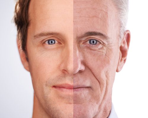 Facelift mannen