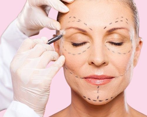Ooglidcorrectie Dr Nelissen