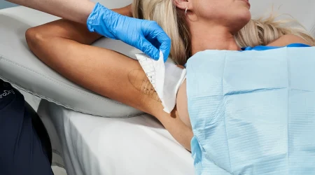 MiraDry Global Care Clinic België